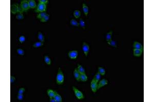 Immunofluorescent analysis of HepG2 cells using ABIN7159344 at dilution of 1:100 and Alexa Fluor 488-congugated AffiniPure Goat Anti-Rabbit IgG(H+L) (MLC1 antibody  (AA 1-49))