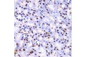 Immunohistochemistry of paraffin-embedded rat pancreas using XRCC4 antibody at dilution of 1:200 (400x lens). (XRCC4 antibody)