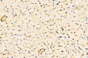 Immunohistochemistry (Paraffin-embedded Sections) (IHC (p)) image for anti-Dystrophia Myotonica-Protein Kinase (DMPK) antibody (ABIN7073790)