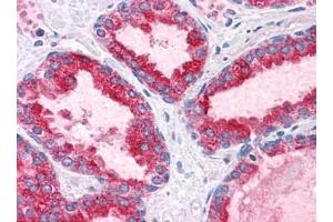 Human Prostate: Formalin-Fixed, Paraffin-Embedded (FFPE) (BCAS1 antibody  (C-Term))