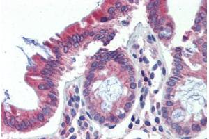 Human Colon (formalin-fixed, paraffin-embedded) stained with POLDIP3 antibody ABIN462229 followed by biotinylated goat anti-rabbit IgG secondary antibody ABIN481713, alkaline phosphatase-streptavidin and chromogen. (POLDIP3 antibody  (AA 326-375))