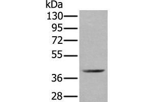 Western blot analysis of Mouse kidney tissue lysate using WDFY2 Polyclonal Antibody at dilution of 1:350 (WDFY2 antibody)