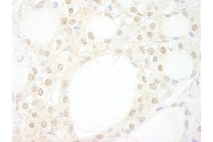 Immunohistochemistry (IHC) image for anti-WD Repeat Domain 20 (WDR20) (AA 450-500) antibody (ABIN7448862) (WDR20 antibody  (AA 450-500))