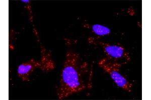 Proximity Ligation Analysis of protein-protein interactions between MMP2 and TGFB1. (TGFB1 antibody  (AA 279-390))