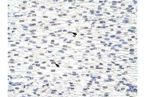 SNRPF antibody was used for immunohistochemistry at a concentration of 4-8 ug/ml to stain Myocardial cells (arrows) in Human Heart. (SNRPF antibody  (N-Term))