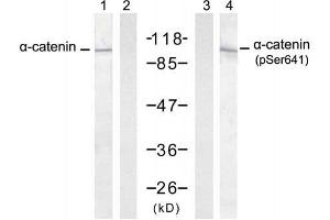 Western blot analysis of extract from A431 cells, untreated or treated with EGF (200ng/ml, 30min), using α-catenin (Ab-641) antibody (E021330, Lane 1 and 2) and α-catenin (Phospho-Ser641) antibody (E011330, Lane 3 and 4). (CTNNA1 antibody  (pSer641))