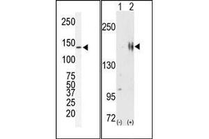 (LEFT)Western blot analysis of anti-ErbB2 Pab in SKBR-3 cell lysate. (ErbB2/Her2 antibody  (N-Term))