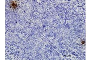 Image no. 3 for anti-Tissue Factor Pathway Inhibitor 2 (TFPI2) (AA 1-236) antibody (ABIN599020) (TFPI2 antibody  (AA 1-236))