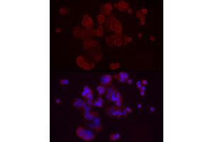 Immunofluorescence analysis of MCF7 cells using DKK3 Rabbit pAb (ABIN3016192, ABIN3016193, ABIN3016194, ABIN1679536 and ABIN6219615) at dilution of 1:50 (40x lens). (DKK3 antibody  (AA 22-350))