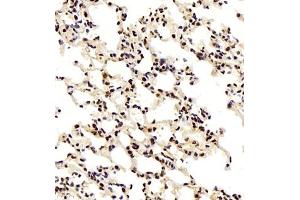 Immunohistochemistry of paraffin embedded mouse lung using smad62024 (ABIN7075629) at dilution of 1:1000 (400x lens) (SMAD6 antibody)