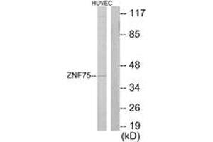 Western blot analysis of extracts from HuvEc cells, using ZNF75 Antibody.