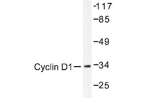 Image no. 1 for anti-Cyclin D1 (CCND1) antibody (ABIN272112) (Cyclin D1 antibody)