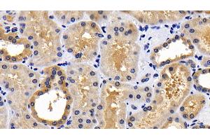 Immunohistochemistry (IHC) image for anti-BCL2-Associated Agonist of Cell Death (BAD) (AA 1-168) antibody (ABIN7443224)