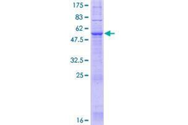 JKAMP Protein (AA 1-311) (GST tag)