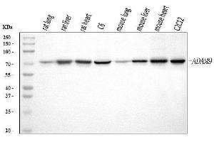 Western blot analysis of ADAM9 using anti-ADAM9 antibody (ABIN7601124). (ADAM9 antibody  (AA 29-307))