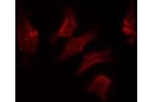 ABIN6278570 staining HuvEc by IF/ICC. (FASTKD2 antibody  (Internal Region))