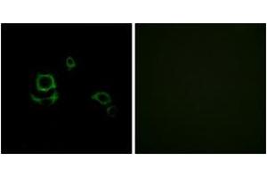 Immunofluorescence analysis of HuvEc cells, using F13B Antibody. (F13B antibody  (AA 61-110))