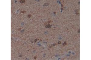 Immunohistochemistry (IHC) image for anti-Ribosomal Protein S6 Kinase, 70kDa, Polypeptide 2 (RPS6KB2) (AA 194-453) antibody (ABIN1860472)