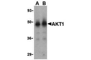Western Blotting (WB) image for anti-V-Akt Murine Thymoma Viral Oncogene Homolog 1 (AKT1) (N-Term) antibody (ABIN1031225) (AKT1 antibody  (N-Term))
