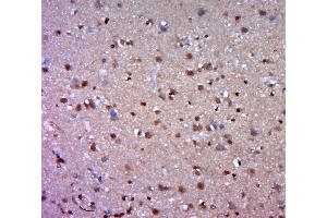 Paraformaldehyde-fixed, paraffin embedded human brain glioma; Antigen retrieval by boiling in sodium citrate buffer (pH6. (EFCAB12 antibody  (AA 421-520))