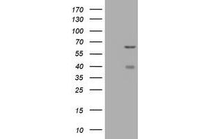 Image no. 2 for anti-CNKSR Family Member 3 (CNKSR3) antibody (ABIN1497550) (CNKSR3 antibody)