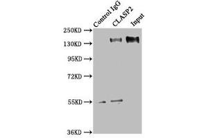 Immunoprecipitating CLASP2 in HEK293 whole cell lysate Lane 1: Rabbit control IgG instead of ABIN7147936 in HEK293 whole cell lysate. (CLASP2 antibody  (AA 226-381))