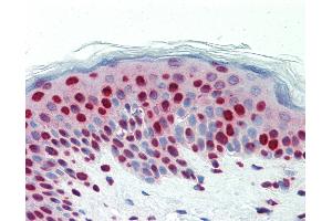Anti-DCLRE1C / Artemis antibody IHC staining of human skin. (DCLRE1C antibody  (AA 21-50))