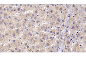 Detection of C1qB in Human Liver Tissue using Polyclonal Antibody to Complement Component 1, Q Subcomponent B (C1qB) (C1QB antibody  (AA 28-253))