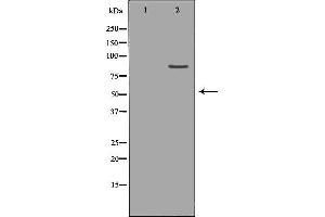 Western blot analysis of Hepg2 whole cell lysates, using CLCN5 Antibody. (Chloride Channel 5 antibody  (Internal Region))