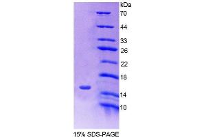 SDS-PAGE analysis of Human SLC30A3 Protein. (Slc30a3 Protein)