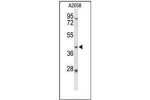 Western blot analysis of FUT3 Antibody (C-term) in A2058 cell line lysates (35ug/lane).