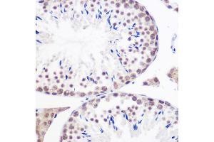 Immunohistochemistry of paraffin-embedded mouse testis using GMNN Rabbit pAb (ABIN6129382, ABIN6141186, ABIN6141187 and ABIN6220942) at dilution of 1:100 (40x lens). (Geminin antibody  (AA 1-209))