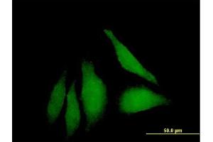 Immunofluorescence of purified MaxPab antibody to WDSUB1 on HeLa cell. (WDSUB1 antibody  (AA 1-384))