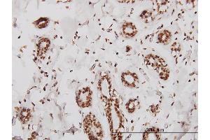 Immunostaining (ISt) image for anti-SWI/SNF Related, Matrix Associated, Actin Dependent Regulator of Chromatin, Subfamily D, Member 2 (SMARCD2) (AA 398-474) antibody (ABIN562914)