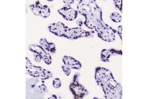 IHC analysis of RbAp48 using anti-RbAp48 antibody (ABIN5692929).
