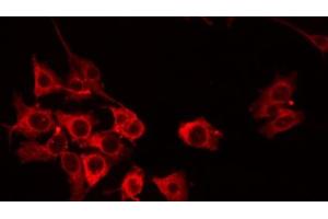 ABIN6274807 staining HuvEc by IF/ICC. (ACOT8 antibody  (Internal Region))