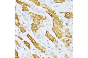 Immunohistochemistry (IHC) image for anti-Cytochrome P450, Family 2, Subfamily E, Polypeptide 1 (CYP2E1) (AA 234-493) antibody (ABIN3023079)