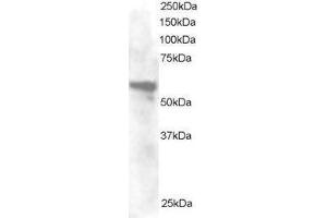 Image no. 2 for anti-Annexin A11 (ANXA11) (N-Term) antibody (ABIN374162) (Annexin A11 antibody  (N-Term))