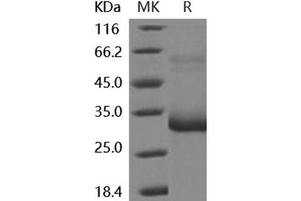 MBL2 Protein (His tag)