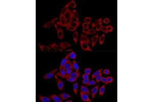 Confocal immunofluorescence analysis of HeLa cells using RRBP1 Polyclonal Antibody (ABIN6132872, ABIN6147259, ABIN6147260 and ABIN6215844) at dilution of 1:100. (RRBP1 antibody  (AA 1-140))