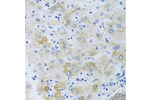 Immunohistochemistry of paraffin-embedded human liver using SLC4 antibody (ABIN6132890, ABIN6148015, ABIN6148016 and ABIN6214688) at dilution of 1:100 (40x lens). (NBC4 antibody  (AA 1042-1121))