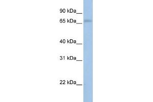 WB Suggested Anti-MAP3K2  Antibody Titration: 0. (MAP3K2 antibody  (N-Term))