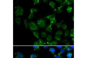 Immunofluorescence analysis of HeLa cells using MAPRE2 Polyclonal Antibody (MAPRE2 antibody)