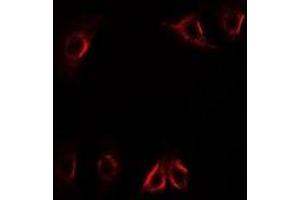 Immunofluorescent analysis of Axin-2 staining in U2OS cells. (AXIN2 antibody)