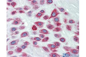 Human Placenta (LIMD1 antibody  (N-Term))