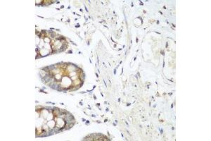 Immunohistochemistry of paraffin-embedded human colon using VEGFR3/FLT4 antibody (ABIN6130780, ABIN6140699, ABIN6140702 and ABIN6221242) at dilution of 1:200 (40x lens). (FLT4 antibody  (AA 1174-1363))