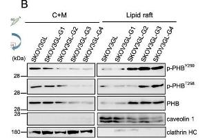 Western Blotting (WB) image for anti-Caveolin 1, Caveolae Protein, 22kDa (CAV1) (N-Term) antibody (ABIN2854651)
