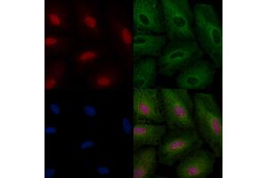 ABIN6264705 and ABIN6266630 staining  cells by IF/ICC.