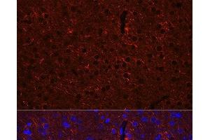 Immunofluorescence analysis of Mouse brain using GAD2 Polyclonal Antibody at dilution of 1:100 (40x lens). (GAD65 antibody)