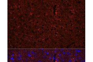 Immunofluorescence analysis of Mouse brain using GAD2 Polyclonal Antibody at dilution of 1:100 (40x lens). (GAD65 antibody)